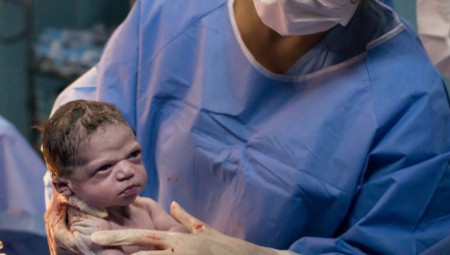 Izabela Pereira de Hesus, devojčica iz Brazila, postala je globalna internet senzacija čim je došla na svet - i to zahvaljujući jednoj jedinoj fotografiji