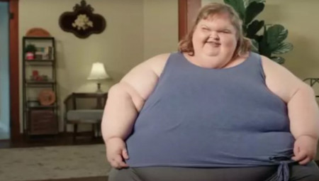 Tami je u proteklih pet godina skinula čak 245 kilograma. Nedavno je imala i operaciju uklanjanja viška kože