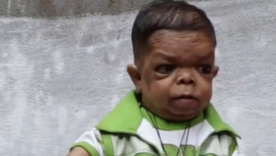 najmanji čovek u Indiji