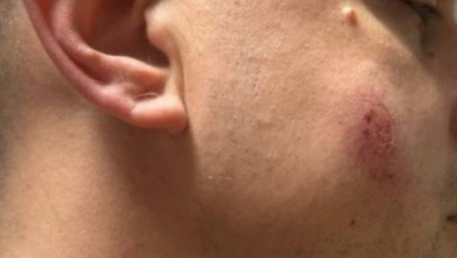 Povređen policajac u Pančevu