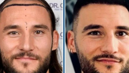 Pre godinu dana Nemanja je bio na operaciji bio u Turskoj