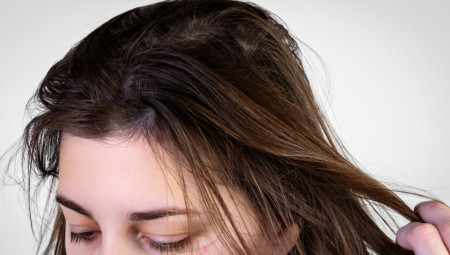Svaka žena sanja o lepoj, negovanoj kosi, ali šta uraditi kada se kosa prebrzo masti?