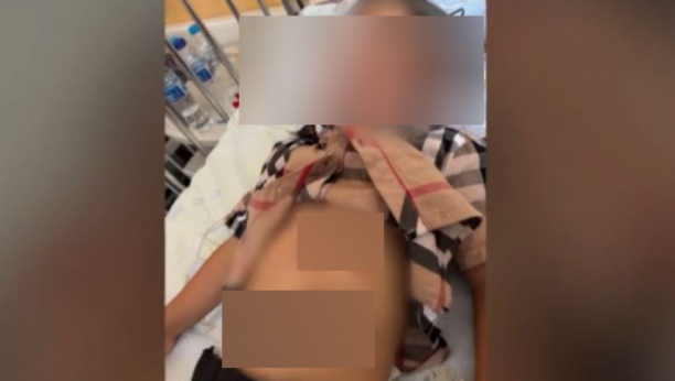 Dete iz Beograda napao vuk na plaži