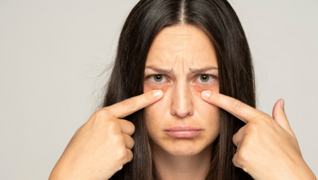 JEDNOSTAVAN TRIK Evo kako da se na prirodan način rešite tamnih podočnjaka