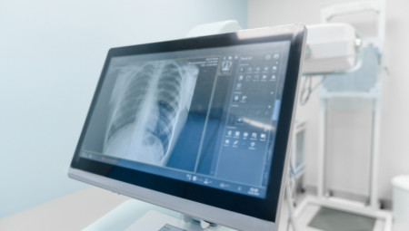 Istraživanje je otkrilo da 3 popularne pop pesme mogu da pomognu u lečenju bolesti pluća.