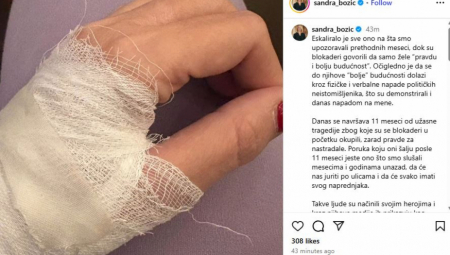 Prvo je došlo do nesporazuma u saobraćaju, ali kada me je prepoznala nastao je potpuni haos, takvo nasilje još nisam videla, navela je Sandra Božić, potpredsednica pokrajinske Vlade i članica Predsedništva SNS.