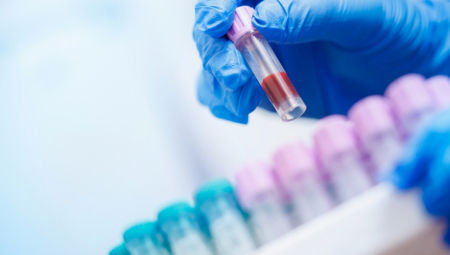 Nacionalni zdravstveni centar Mađarske (NNGYK) upozorio je danas na nastavak širenja hepatitisa A i poručio da je pranje ruku najbolji vid prevencije