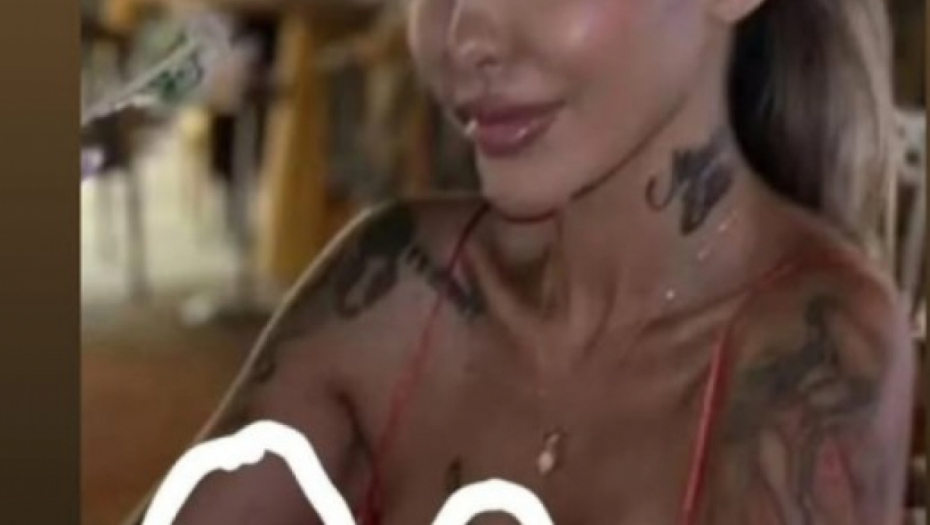 Aneli Ahmić u modricama