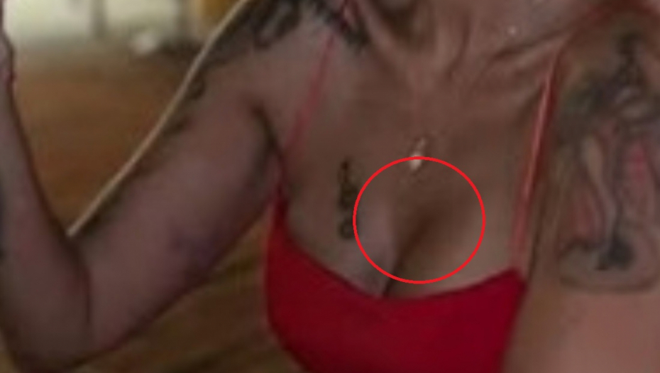 Aneli Ahmić modrice