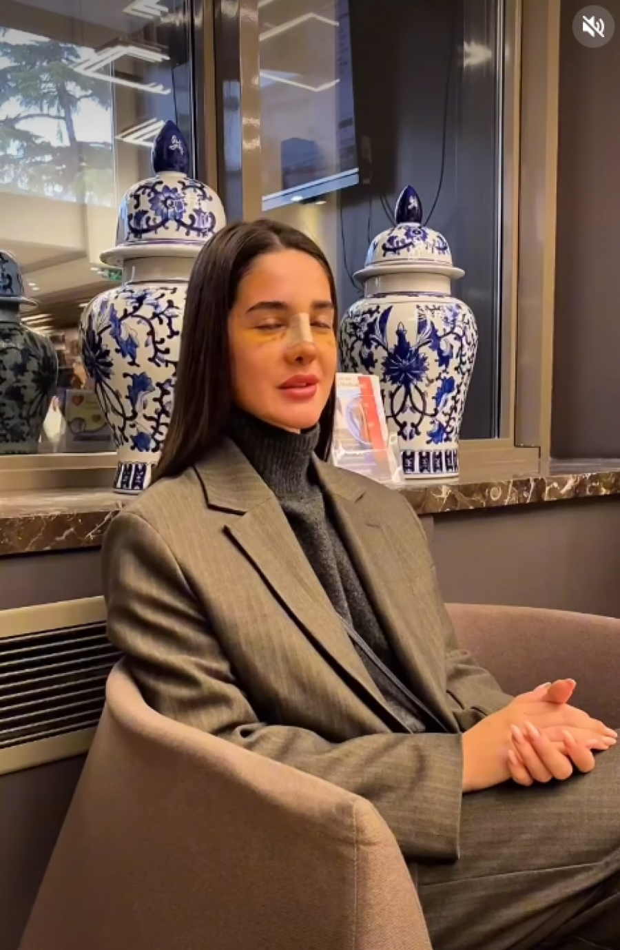 ANĐELINA TAJNA ISPLIVALA NA POVRŠINU! Đuričićeva uhvaćena u novoj laži nakon operacije nosa, evo šta je zapravo prava istina (FOTO)