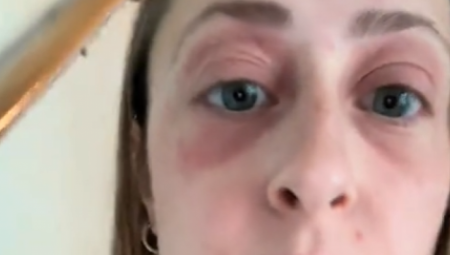 Nedugo nakon što je u maju 2024. postala vlasnica kuće, Sara je iznenada dobila osip na kapcima