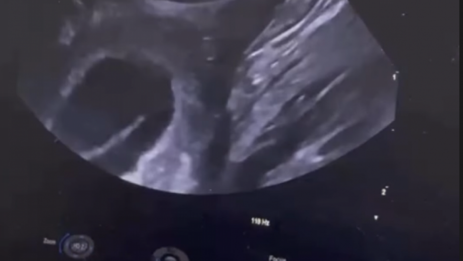 Foto: Printscreen/instagram