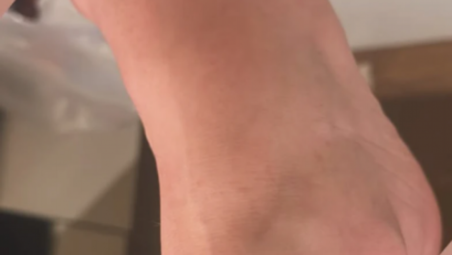 Dušica Jakovljević pokazala povređenu nogu