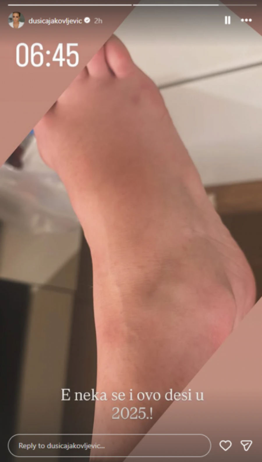 POVREĐENA DUŠICA JAKOVLJEVIĆ Voditeljka pokazala povredu: "E neka se i ovo desi" (FOTO)