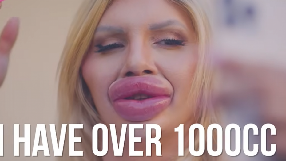 Najveće usne na svetu