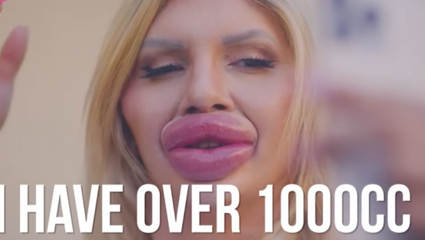 Najveće usne na svetu