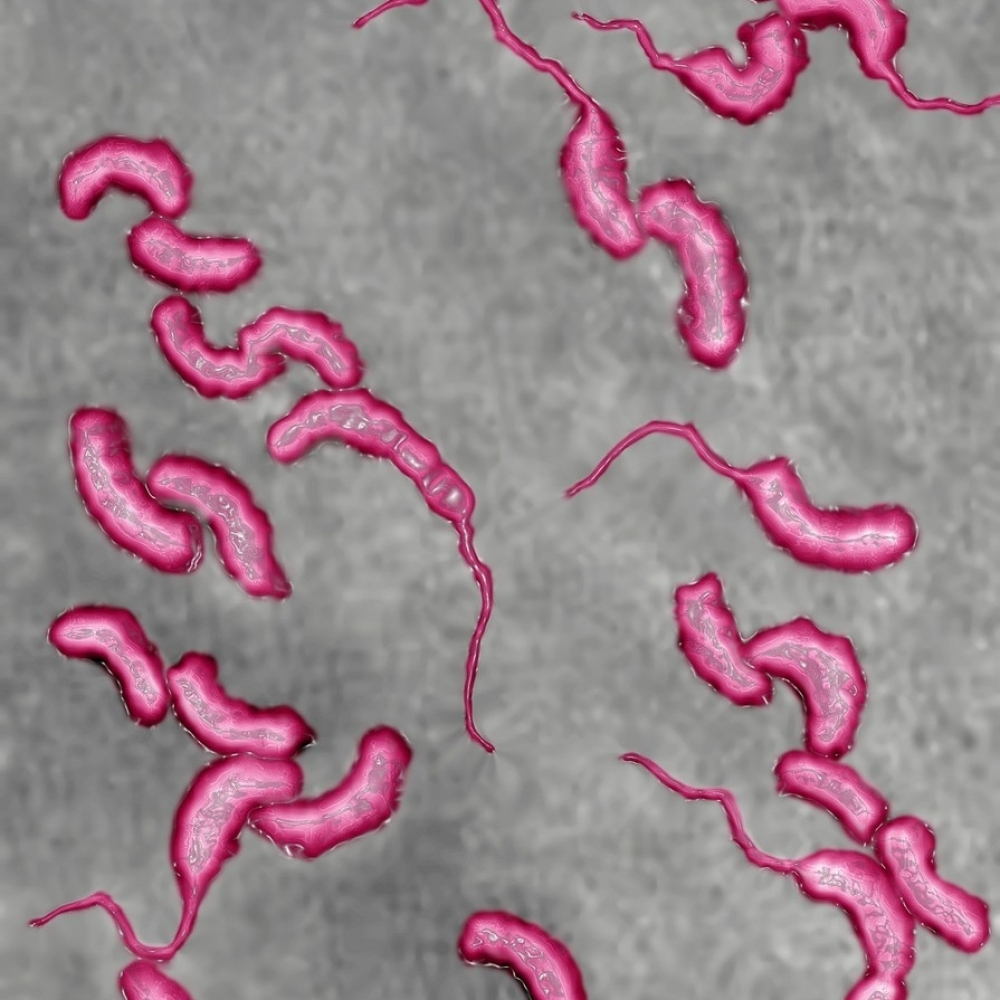 Трутовик окаймленный холерный вибрион. Холерный вибрион аэроб. Вибрионы бактерии. Холерный вибрион это бактерия. Галофильные вибрионы.