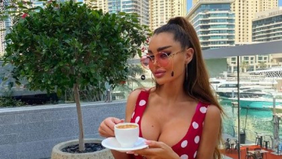 DOKLE BRE VIŠE?! Ana Korać ponovo išla na estetski zahvat, sada izgleda bukvalno kao barbika! (FOTO)