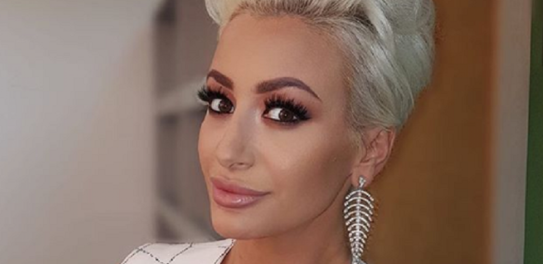 DO SAMOG MESA! Dušica Jakovljević doživela strašnu povredu, voditeljka se odmah oglasila! (FOTO)
