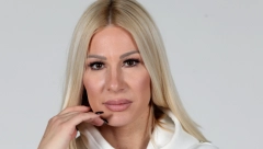 ZANEMEĆETE KADA VIDITE KAKO JE VESNA ĐOGANI IZGLEDALA PRE SVIH OPERACIJA Nikada je ne biste prepoznali, nije ista osoba, šokantno (FOTO)