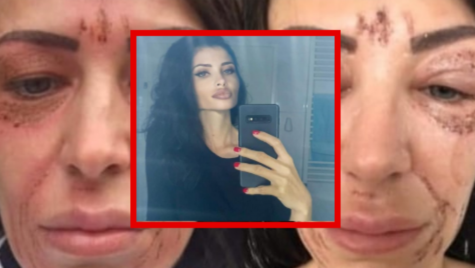 ŽELIM DA DETE VODIM U IGRAONICU I ZOO VRT Nadrilekarka Olgica iznela ove zahteve pred sudiju
