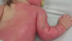 UPOZORENJE ZA RODITELJE: Kako bismo rashladili decu, svi prave ovu grešku, ne sluteći koliko je opasno