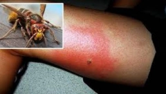 Samo ovo stavite na mesto uboda: Spas kada vas ujede pčela, osa ili stršljen