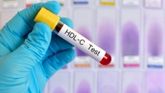 Na prirodan način: Promenite stare i uvedite nove navike, i smanjite holesterol u krvi