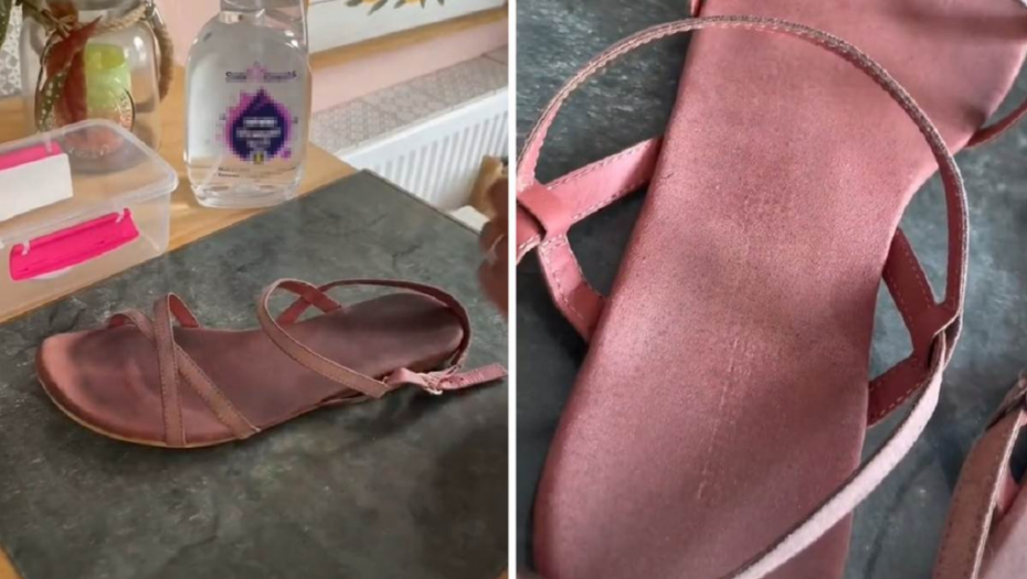 SJAJAN TRIK ZA ČIŠĆENJE SANDALA! Očas posla će biti kao nove