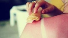 NAJBOLJI DOMAĆI RECEPTI ZA UBLAŽAVANJE OPEKOTINA OD SUNCA: Jeftinih melemi smiriće izgorelu kožu