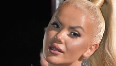 SA SUZAMA U OČIMA POSLALA SNAŽNU PORUKU Sanja Stanković jedva govorila o hororu koji je preživela, a evo zašto danas slavi drugi rođendan