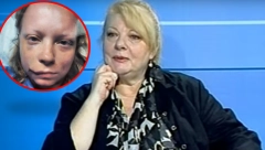 SMRSKANE KOSTI GLAVE: Ćerka poznate glumice otkrila kako je izgledala nakon stravične saobraćajke! (UZNEMIRUJUĆE FOTOGRAFIJE)