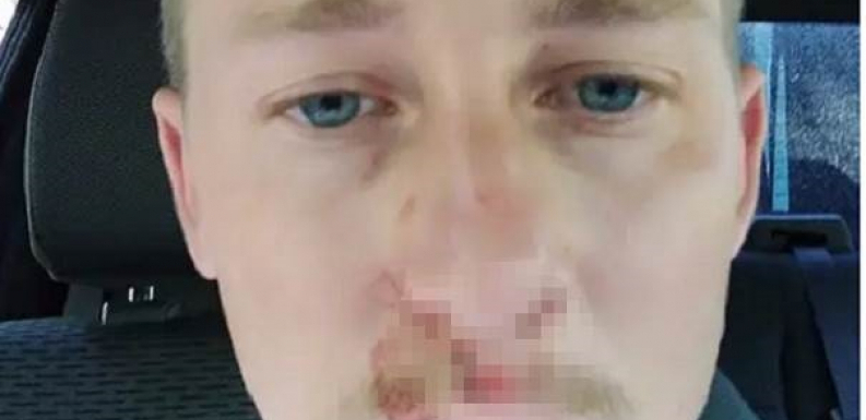 POPIO HLADNU VODU I ONESVESTIO SE: Lekari objasnili da ovu grešku svi pravimo, kad nam je vruće, a može nas koštati života
