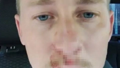 POPIO HLADNU VODU I ONESVESTIO SE: Lekari objasnili da ovu grešku svi pravimo, kad nam je vruće, a može nas koštati života