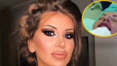 MISLILA SAM DA ĆU DA UMREM, NAJPRE SAM NAPIPALA KUGLICU Dalila prošla kroz pakao zbog silikona u usnama! (UZNEMIRIJUĆE FOTOGRAFIJE)