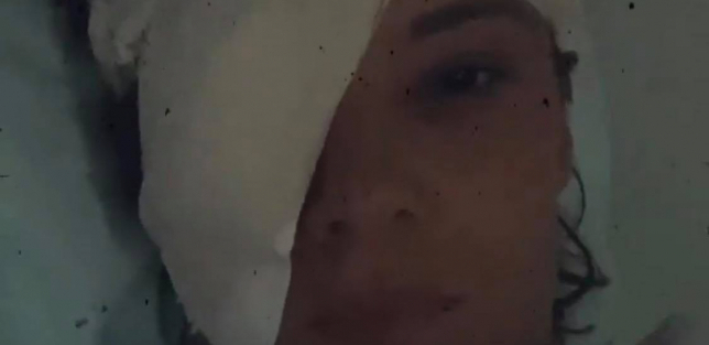 SLAVICI ĆUKTERAŠ LICE U ZAVOJIMA, JEDNO OKO JOJ JE PREKRIVENO SKROZ Pevačica u bolničkom krevetu!