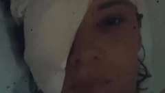 SLAVICI ĆUKTERAŠ LICE U ZAVOJIMA, JEDNO OKO JOJ JE PREKRIVENO SKROZ Pevačica u bolničkom krevetu!