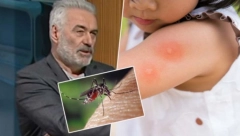 DR NESTOROVIĆ TVRDI: Ako pijete ovaj vitamin, komarci i drugi insekti vam neće ni prići