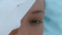 OTKRIVENO ČIME JE SLAVICA ĆUKTERAŠ UMALO IZBILA OKO Pevačici se iskomplikovala povreda, zadržali je na lečenju!