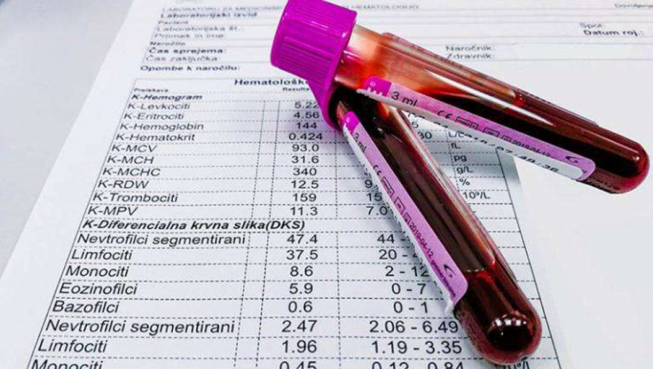 SAČUVAJTE OVAJ TEKST! PROTUMAČITE SAMI KRVNU SLIKU: Evo šta znače skraćenice i na šta njihove vrednosti upućuju
