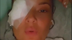 SVI SU SE PLAŠILI ZA NJEN VID Evo kako sada izgleda Slavica Ćukteraš! (FOTO)