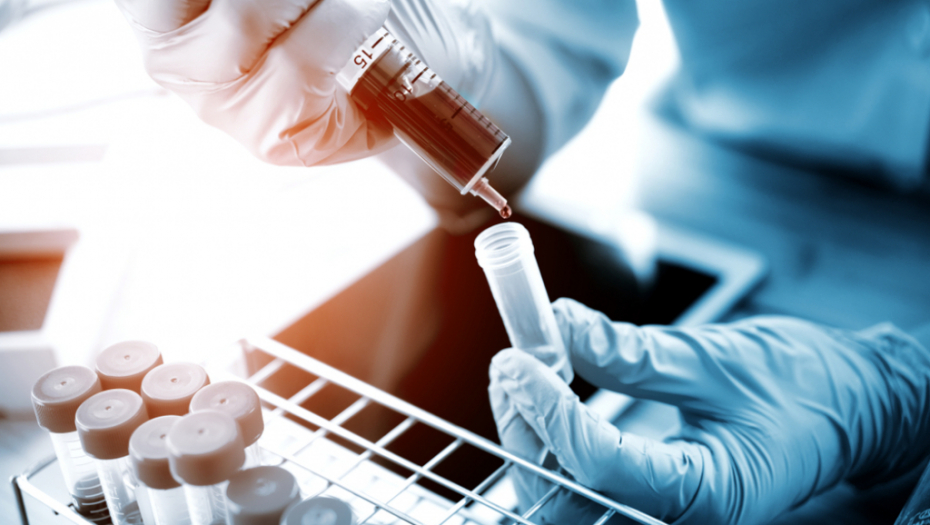 KORONAVIRUS PROCUREO IZ LABORATORIJE! Zvaničnici se oglasili: Prvi slučaj je zaposlena koju je ujeo miš!