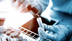 Ruski naučnici pronašli supstacu koja uništava deo HIV-a