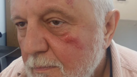 TUKAO ME JE ZBOG DARE IZ JASENOVCA, BJELOGRLIĆ JE KORUPCIONAŠ Jezivi detalji brutalnog prebijanja Gage Antonijevića