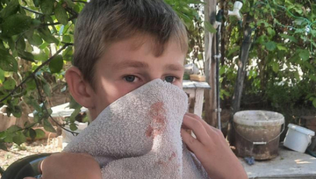 NAPAD NA DEČAKA PODMUKLI UDAR NA SRBE Snažna osuda Srpske liste sramnog čina kosovskih Albanaca