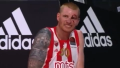 JEZIVO! Povredio se košarkaš Crvene zvezde, krvav se uhvatio za ruku! (VIDEO)