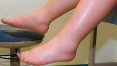 DA LI VAM RUKE I NOGE OTIČU PO OVOJ VRUĆINI? To može da bude znak ozbiljnog oboljenja, evo kako možete sebi da pomognete