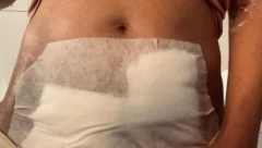 "PUNA SAM OŽILJAKA I TRAUMA"  Dariji su uklonili plod carskim rezom u 13. nedelji, njenu jezivu priču nećete  lako zaboraviti!