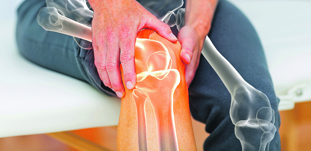 BOL U KOLENU Najveći zglob u ljudskom telu trpi najveće opterećenje, ali mnoštvo tegoba nema uporište u nauci