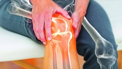 BOL U KOLENU Najveći zglob u ljudskom telu trpi najveće opterećenje, ali mnoštvo tegoba nema uporište u nauci